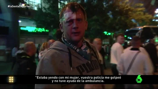 Frame 14.927849 de: UltrasLegiaL6D Frame 14.927849 de: UltrasLegiaL6D
