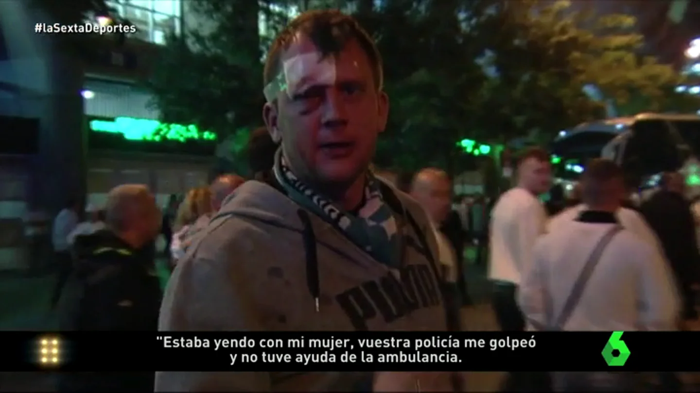 Frame 14.927849 de: UltrasLegiaL6D Frame 14.927849 de: UltrasLegiaL6D