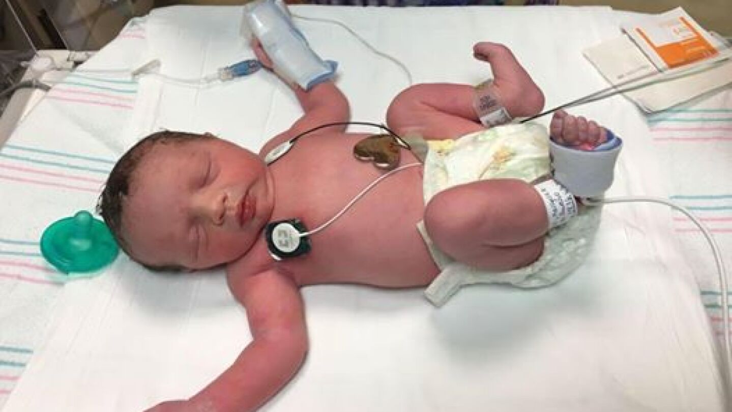 Lynlee Hope, el beb&eacute; que naci&oacute; dos veces