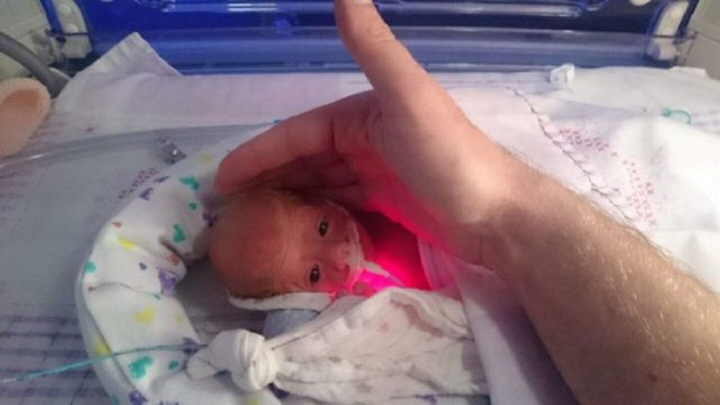 La peque&ntilde;a Pixie al nacer
