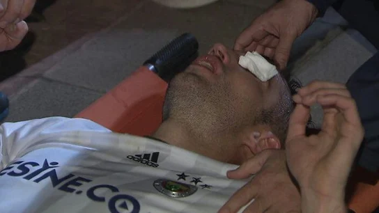 Van Persie, tras sufrir el codazo que casi le hace perder un ojo Van Persie, tras sufrir el codazo que casi le hace perder un ojo