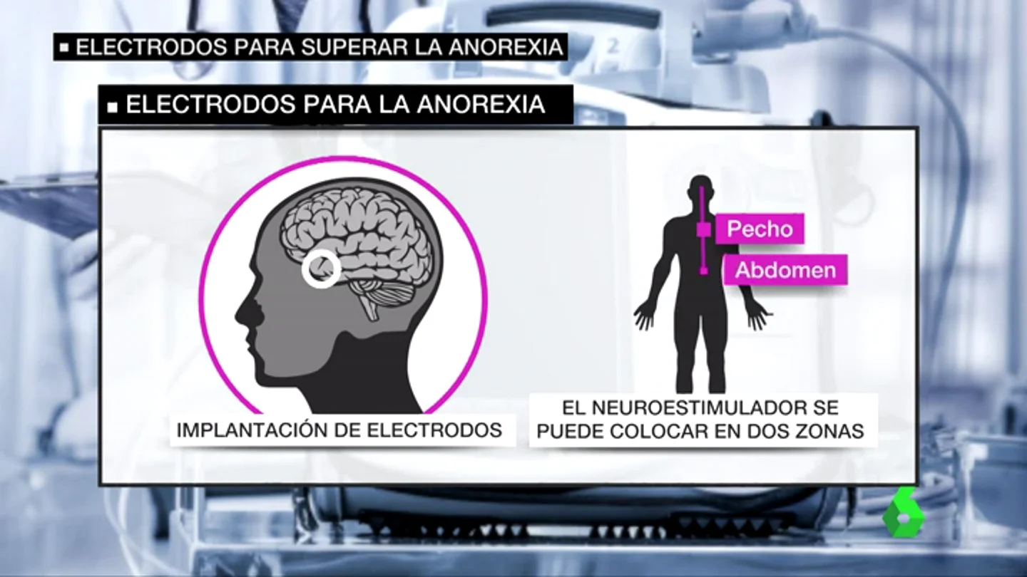 Frame 28.883793 de: ANOREXIA Frame 28.883793 de: ANOREXIA