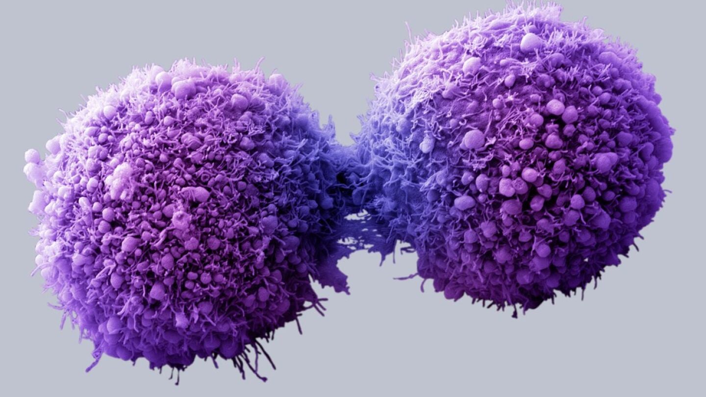 C&eacute;lulas de p&aacute;ncreas cancerosas completando la divisi&oacute;n celular - Getty Images/Visuals Unlimited