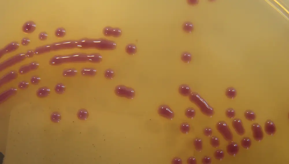 Placa con E. coli resistentes