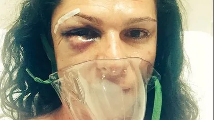 Ana Guevara, excampeona ol&iacute;mpica, sufre una brutal agresi&oacute;n 