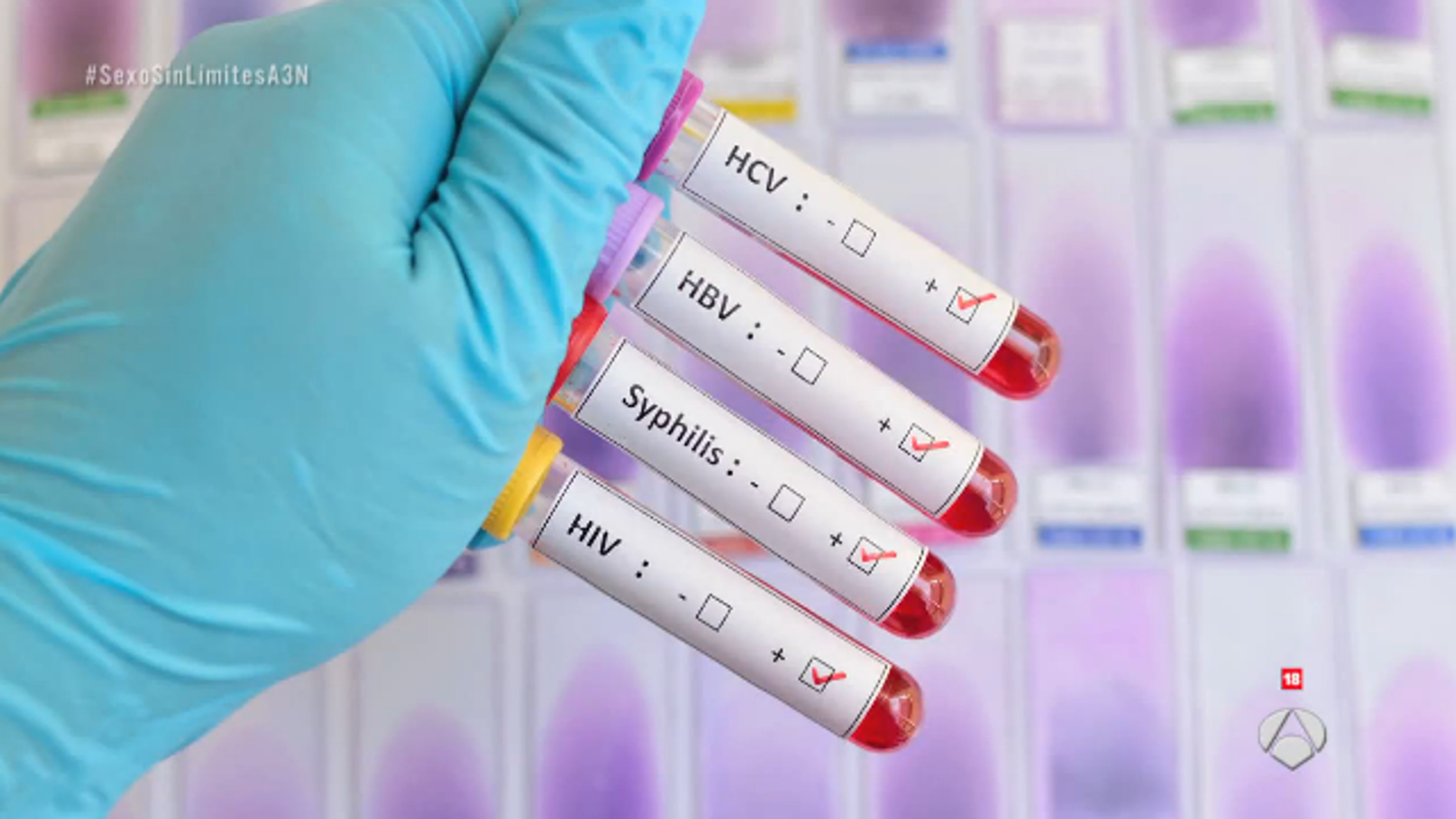 Infecciones de transmisión sexual