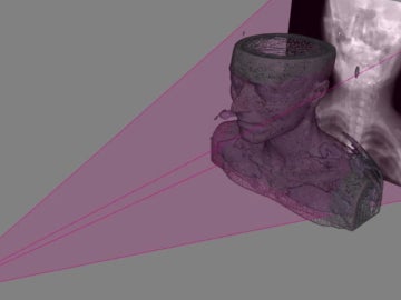 Figuración virtual del sistema que obtiene imágenes 3D a partir de radiografías