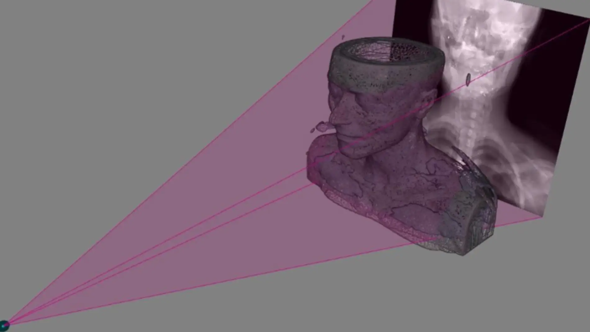 Figuración virtual del sistema que obtiene imágenes 3D a partir de radiografías