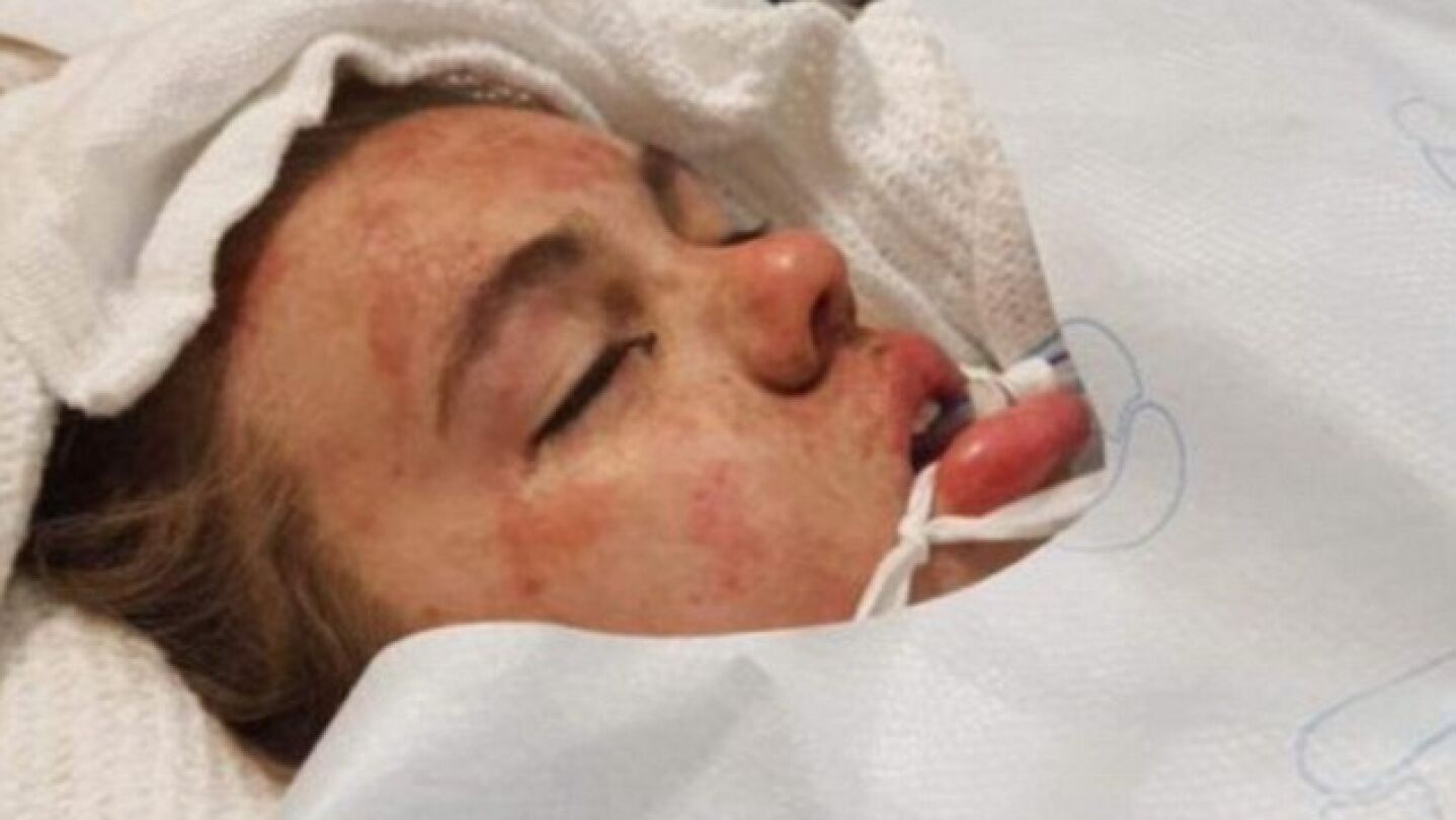 Leah, de 16 a&ntilde;os, hospitalizada tras haber tomaado &eacute;xtasis