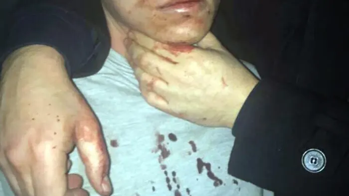 El terrorista del atentado en un club de Estambul El terrorista del atentado en un club de Estambul