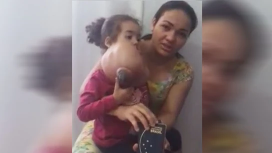 La madre de Melyssa junto a la niña antes de la operación La madre de Melyssa junto a la niña antes de la operación