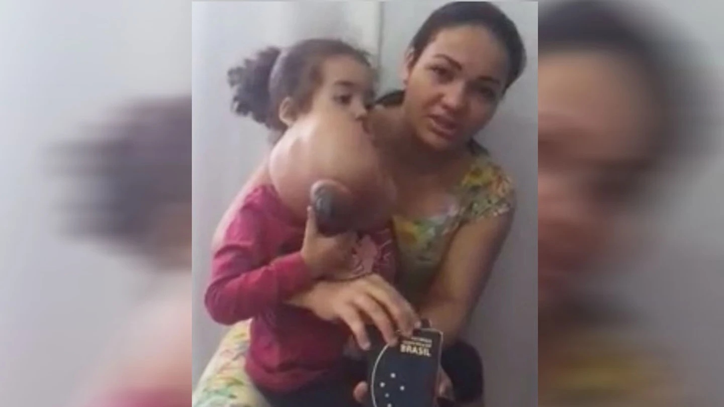 La madre de Melyssa junto a la niña antes de la operación La madre de Melyssa junto a la niña antes de la operación