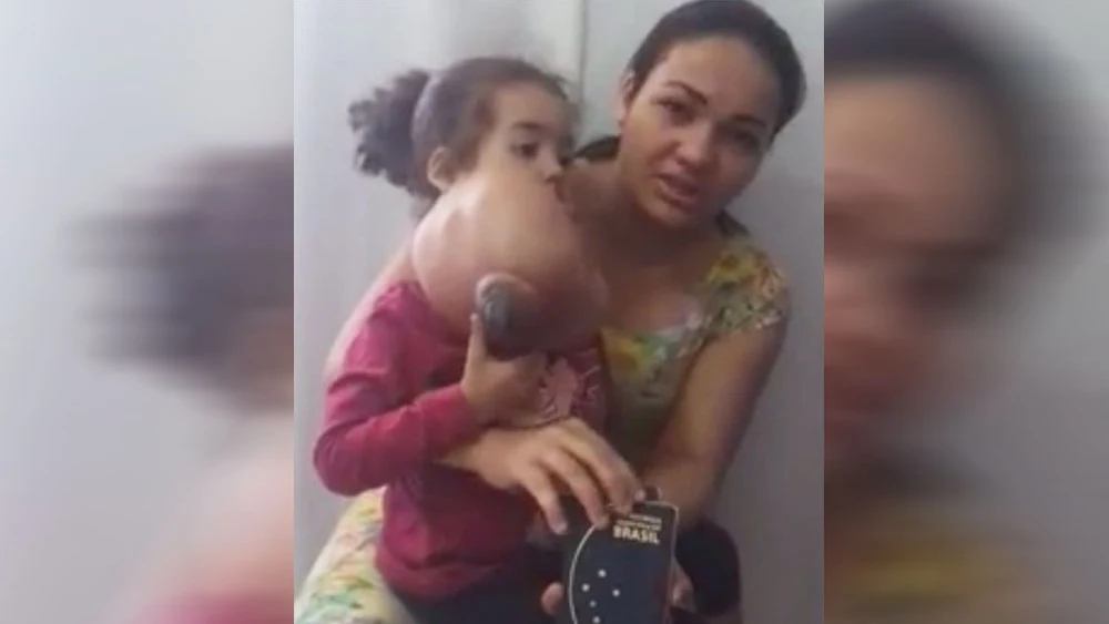 La madre de Melyssa junto a la niña antes de la operación