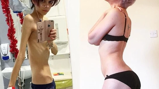 La increíble recuperación de Connie La increíble recuperación de Connie