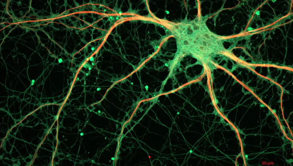 Imagen de una neurona vista al microscopio