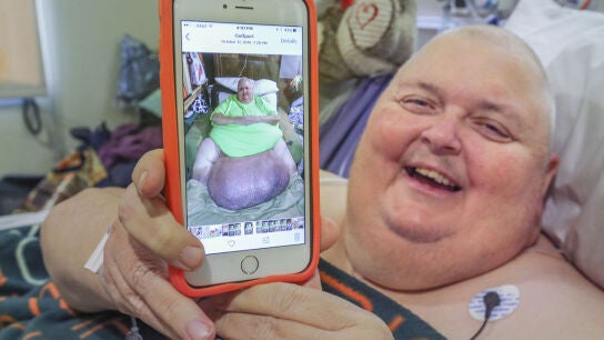 Roger Logan sonr&iacute;e despu&eacute;s de la operaci&oacute;n