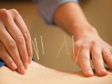 La acupuntura es un elemento clave en la medicina tradicional china. La acupuntura es un elemento clave en la medicina tradicional china.