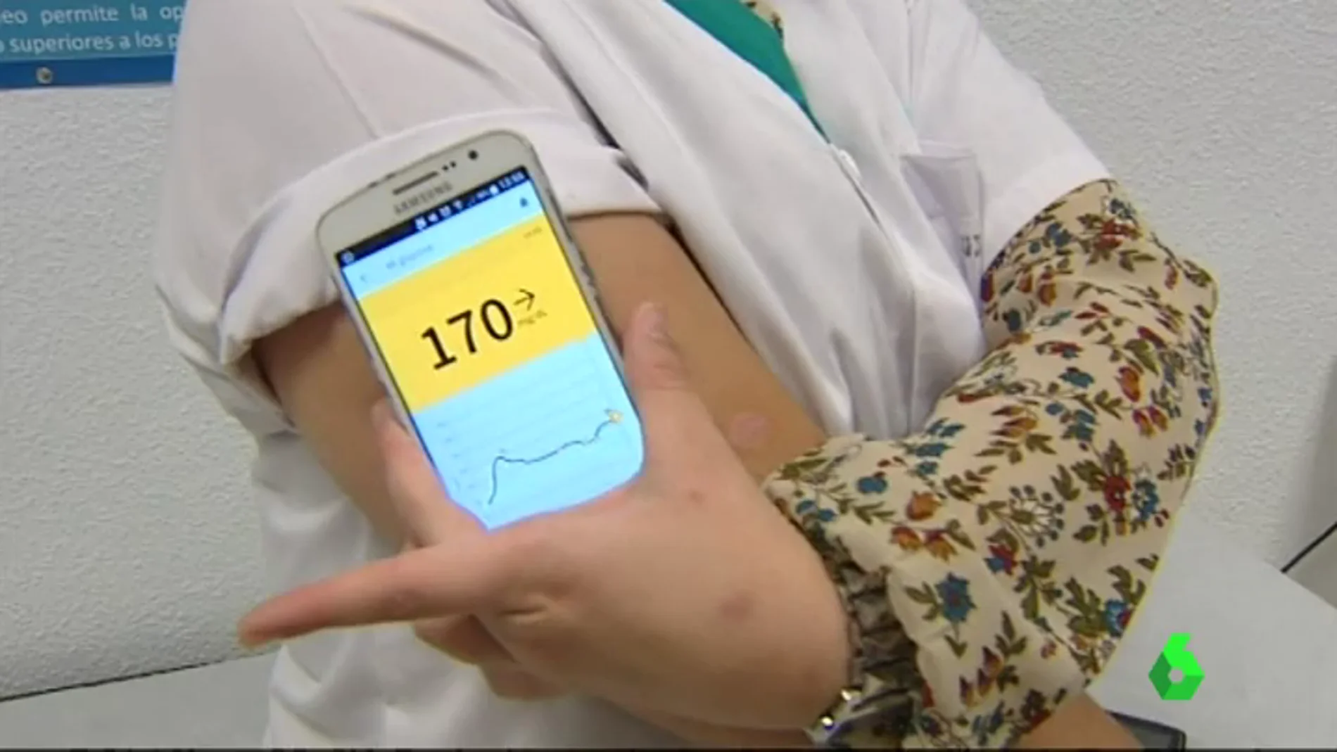 Restricción Tendencia cero Comercializan un sensor conectado al móvil que permite a los diabéticos  medir y anticiparse a una subida o bajada de azúcar sin tener que pincharse