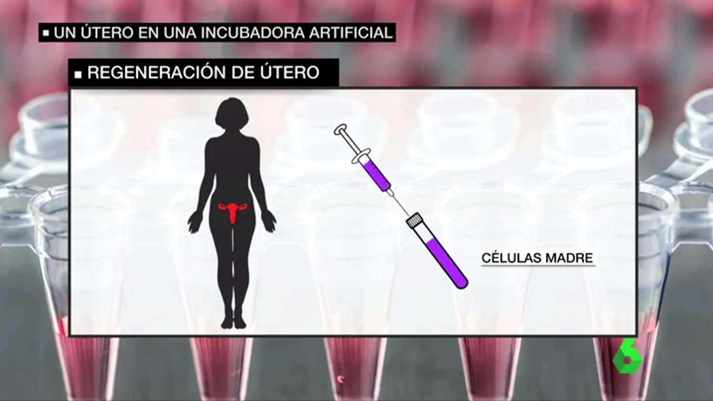 Frame 35.902611 de: utero Frame 35.902611 de: utero