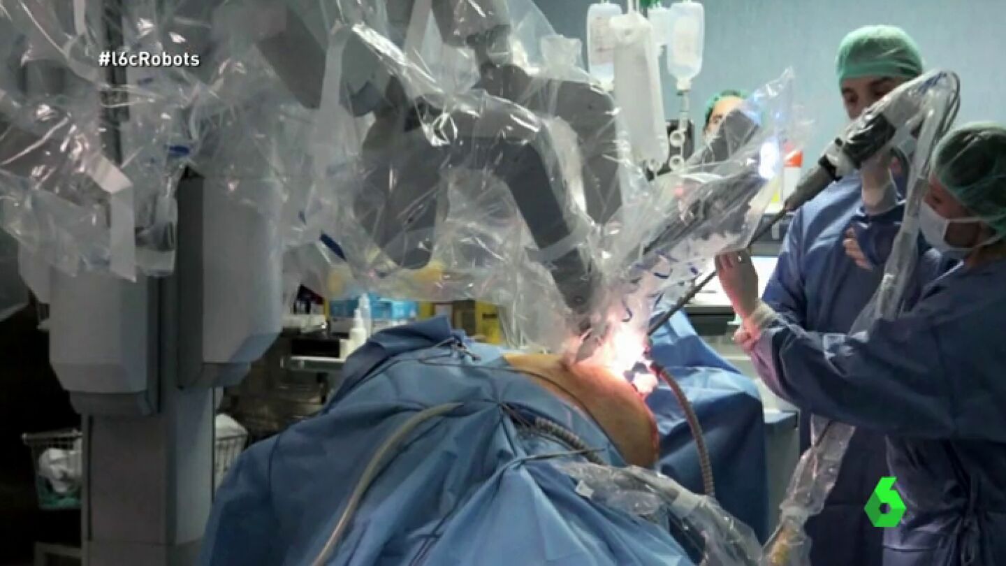 Frame 4.12 de: Da Vinci, el robot cirujano que acumula tres millones de operaciones: "Consigue menor sangrado, m&aacute;s r&aacute;pida recuperaci&oacute;n&hellip;"