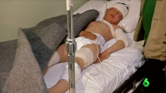 Frame 7.948102 de: Al menos 12 heridos por agentes qu&iacute;micos en la ofensiva por Mosul, Irak 