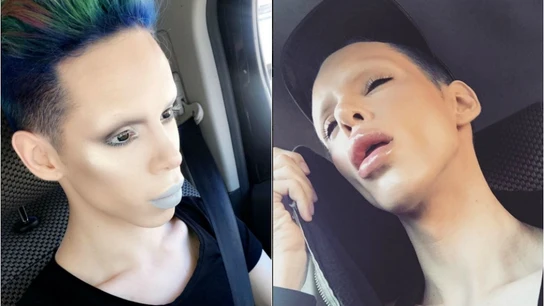 Un joven de 22 años gasta 50.000 dólares en 100 operaciones para transformarse en un "alienígena asexual" Un joven de 22 años gasta 50.000 dólares en 100 operaciones para transformarse en un "alienígena asexual"