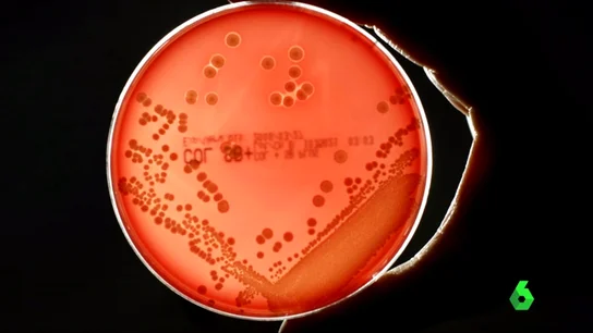 Frame 28.520143 de: ANTIBIOTICOS Frame 28.520143 de: ANTIBIOTICOS