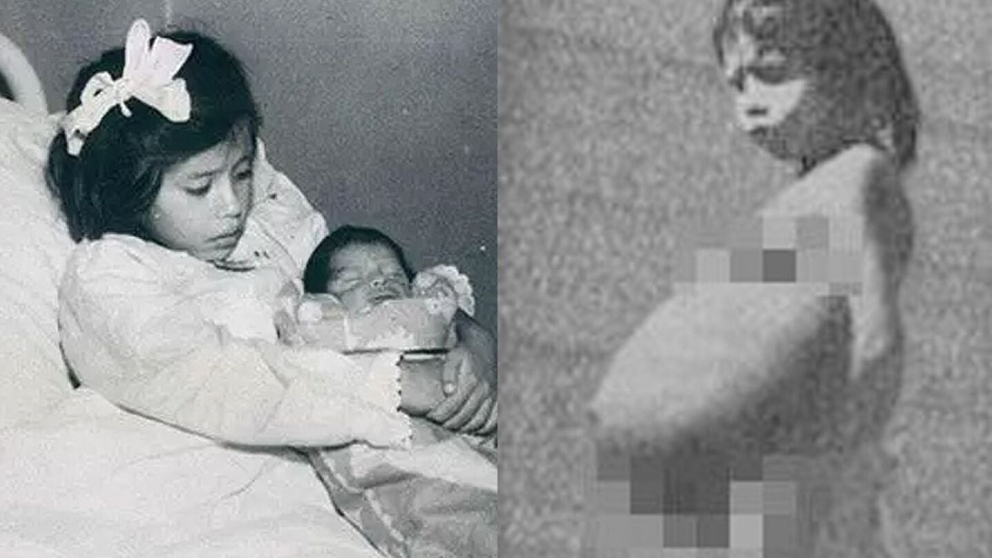  Lina Medina dio a luz a los cinco a&ntilde;os