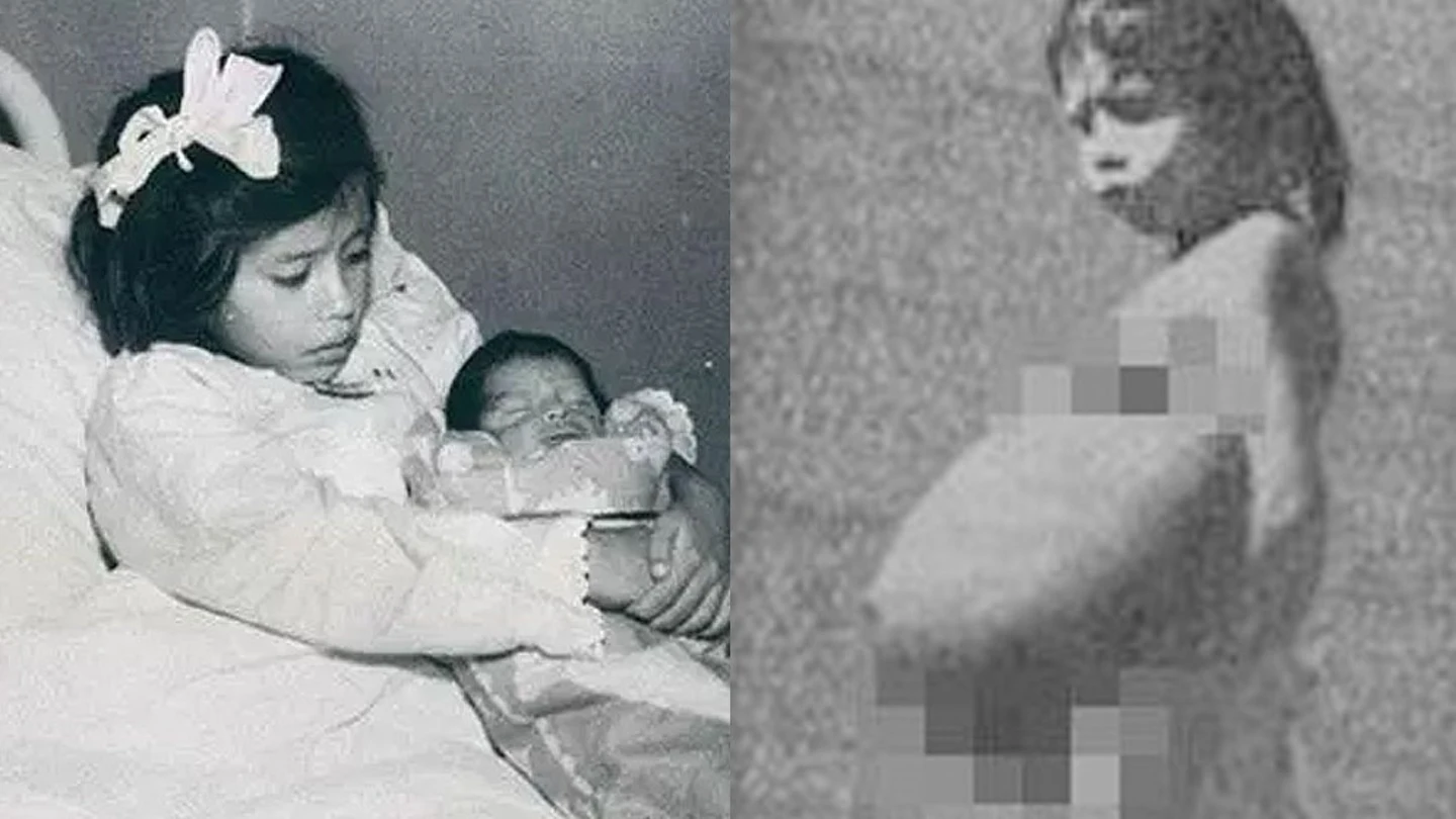 Lina Medina dio a luz a los cinco años Lina Medina dio a luz a los cinco años