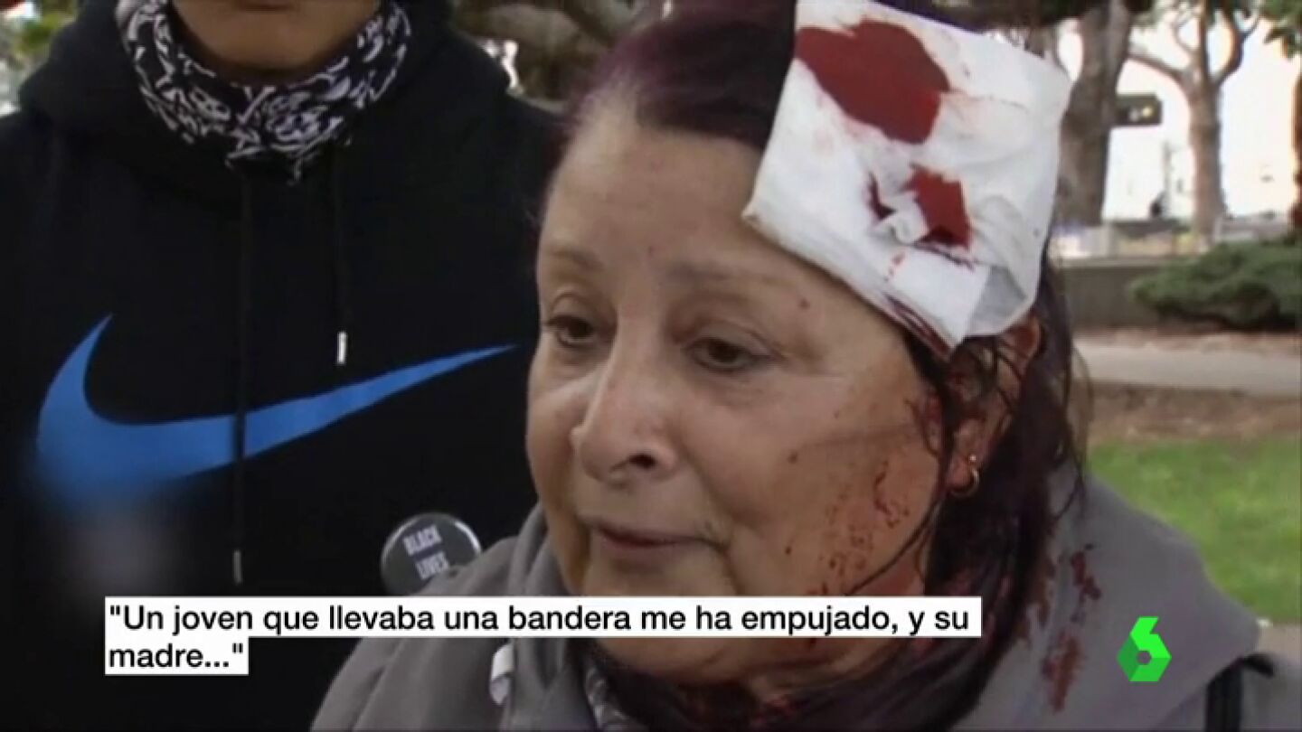 Mujer agredida