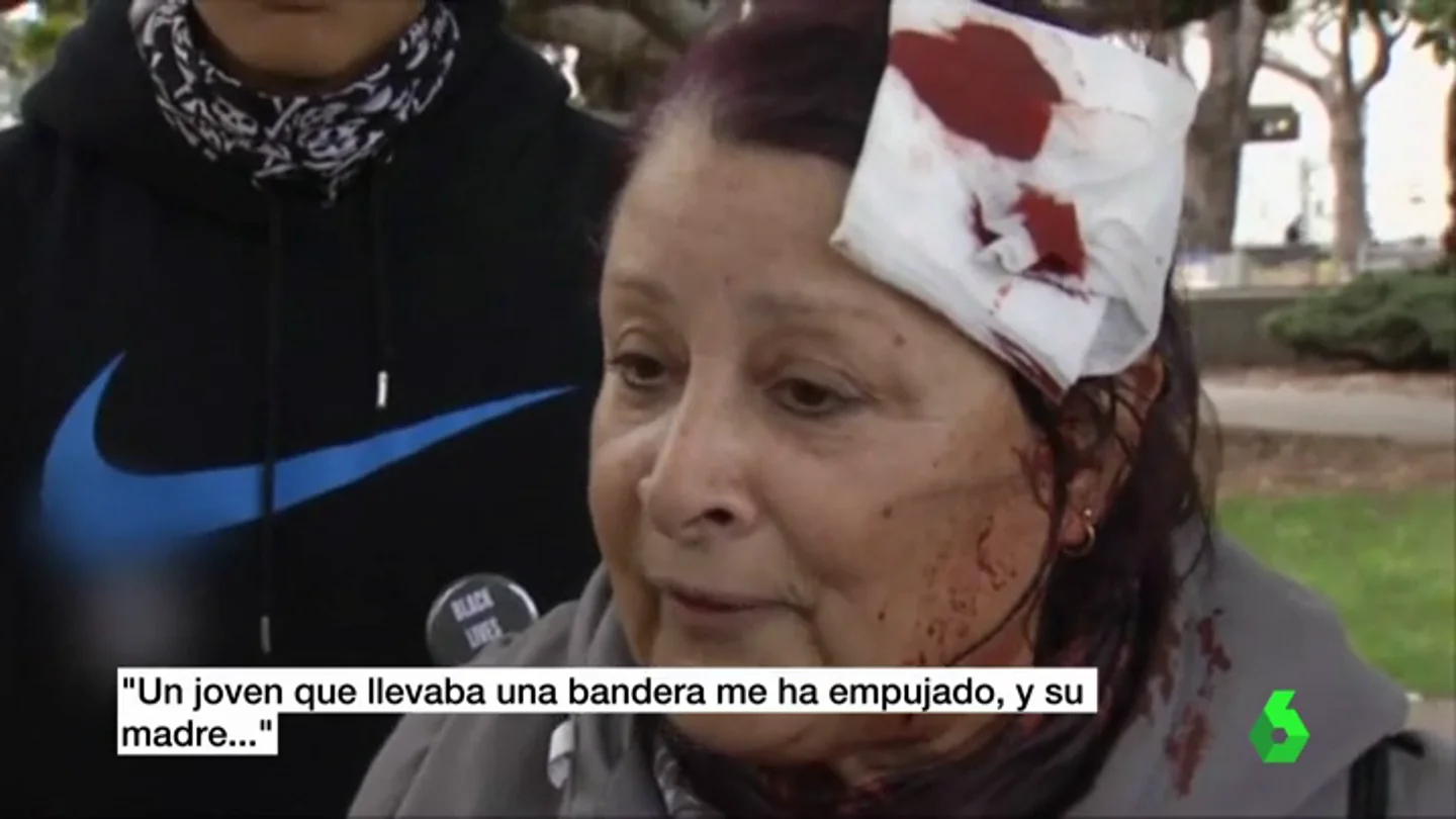 Mujer agredida Mujer agredida