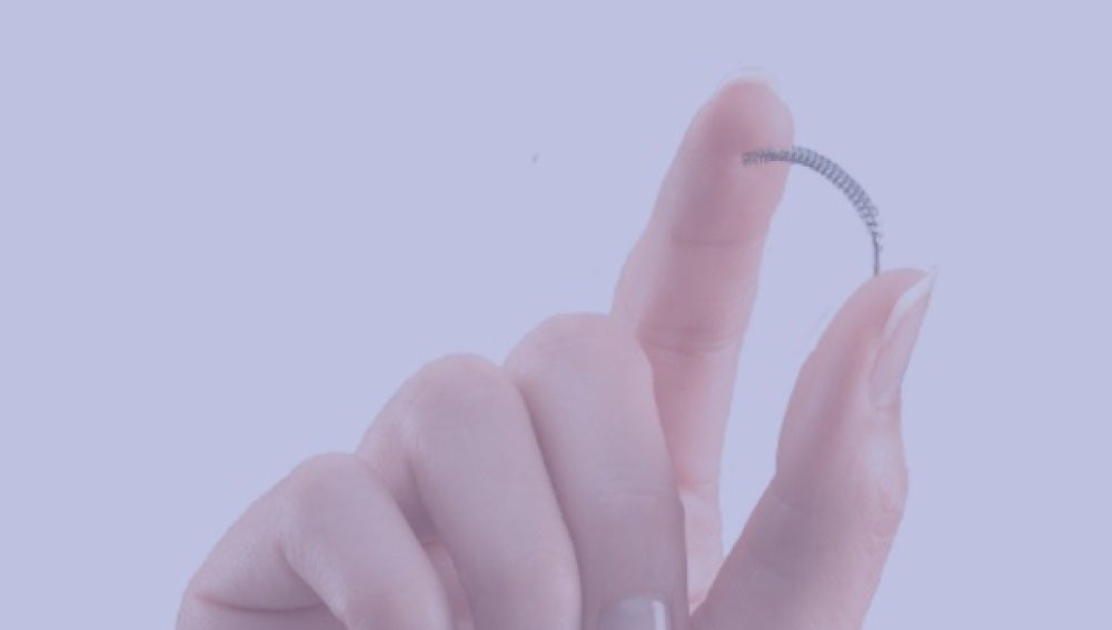 Essure es un pequeño muelle que se usa como anticonceptivo