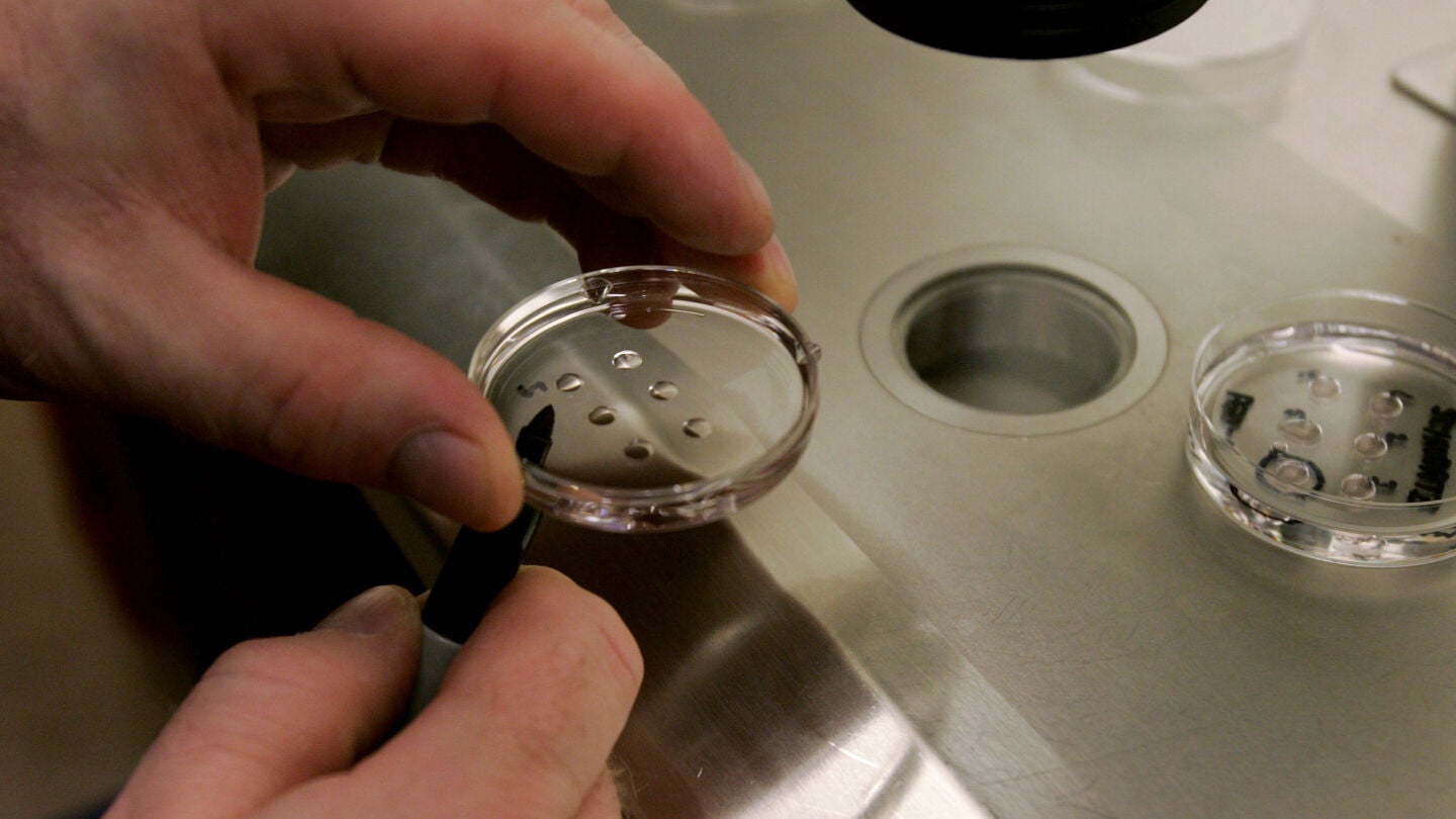 Fecundaci&oacute;n in vitro