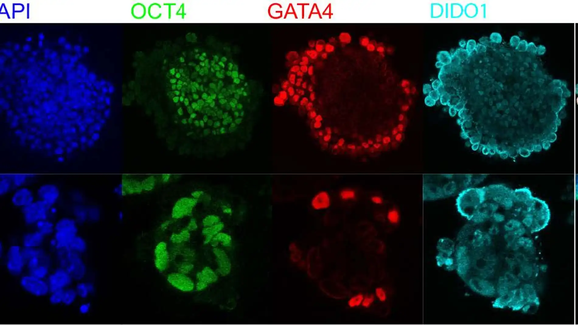 Un interruptor molecular indica a las celulas madre cuando diferenciarse