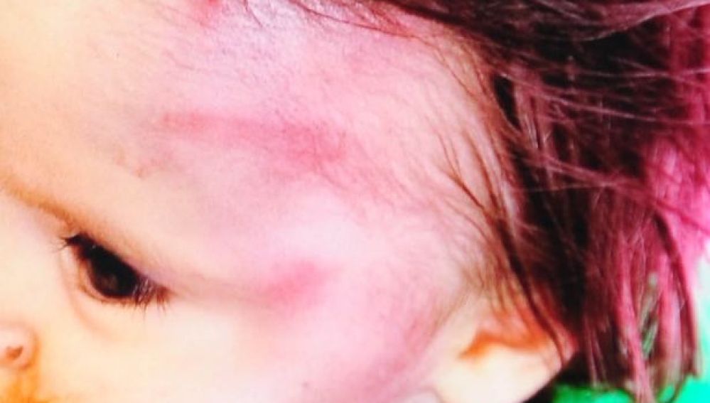 Un bebé de diez meses sufre un fuerte golpe de un ladrillo en la cabeza debido a una disputa entre familias