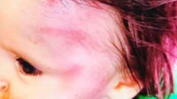 Un bebé de diez meses sufre un fuerte golpe de un ladrillo en la cabeza debido a una disputa entre familias