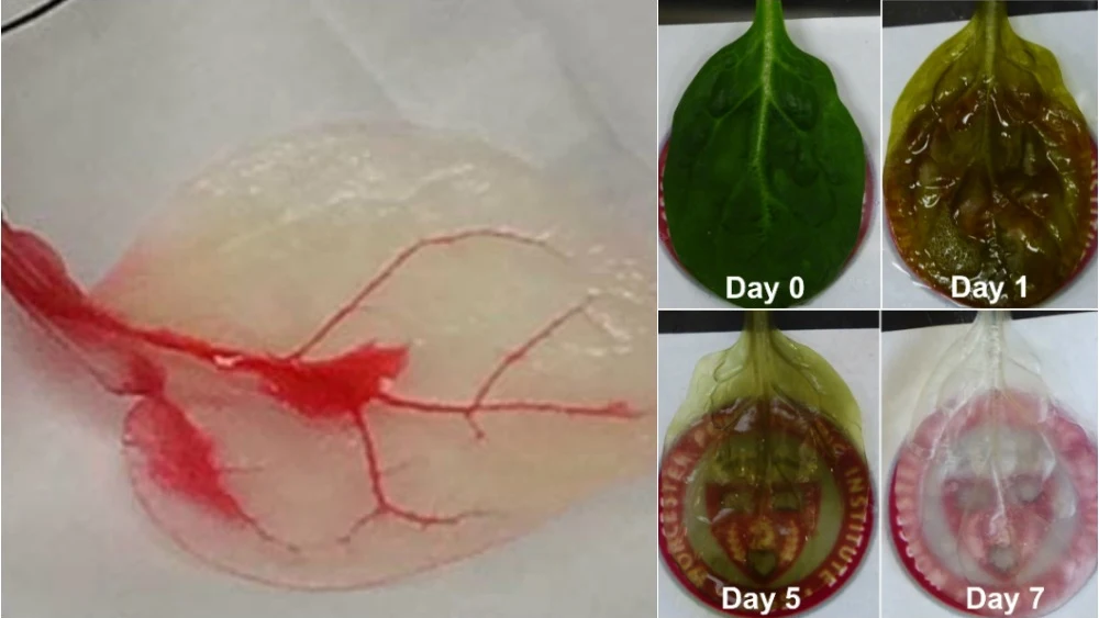 Imágenes de la evolución de la investigacion