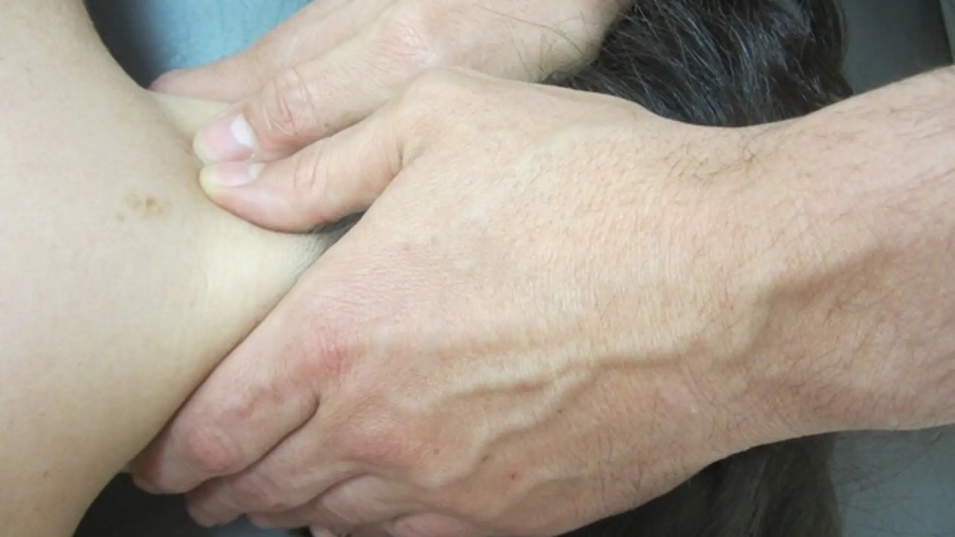 La fisioterapia mejora el sindrome del tunel del carpo en mujeres