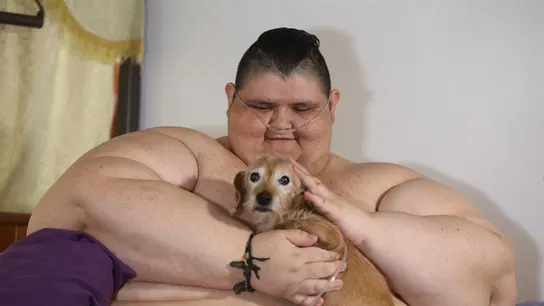 Juan Pedro, el hombre más obeso del mundo, será operado Juan Pedro, el hombre más obeso del mundo, será operado