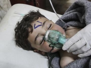 Un niño recibe tratamiento médico tras el ataque químico al norte de Siria Un niño recibe tratamiento médico tras el ataque químico al norte de Siria
