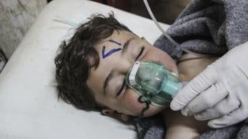 Un niño recibe tratamiento médico tras el ataque químico al norte de Siria