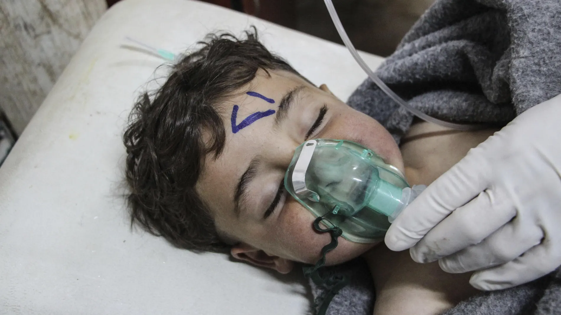 Un niño recibe tratamiento médico tras el ataque químico al norte de Siria