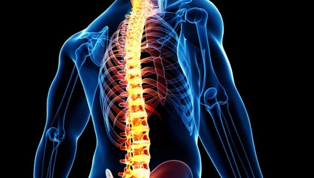 Un paralítico consigue andar debido a un implante de un dispositivo en la médula espinal