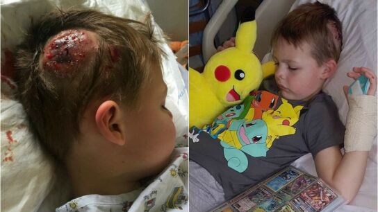 El peque&ntilde;o Jak durante su hospitalizaci&oacute;n 