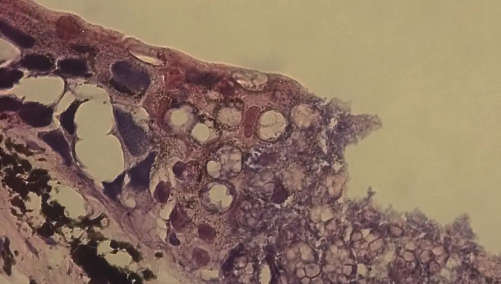 Imagen de la piel de una salamandra infectada con B. salamandrivorans