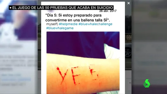 Un adolescente realiza el juego de 'la ballena azul' Un adolescente realiza el juego de 'la ballena azul'