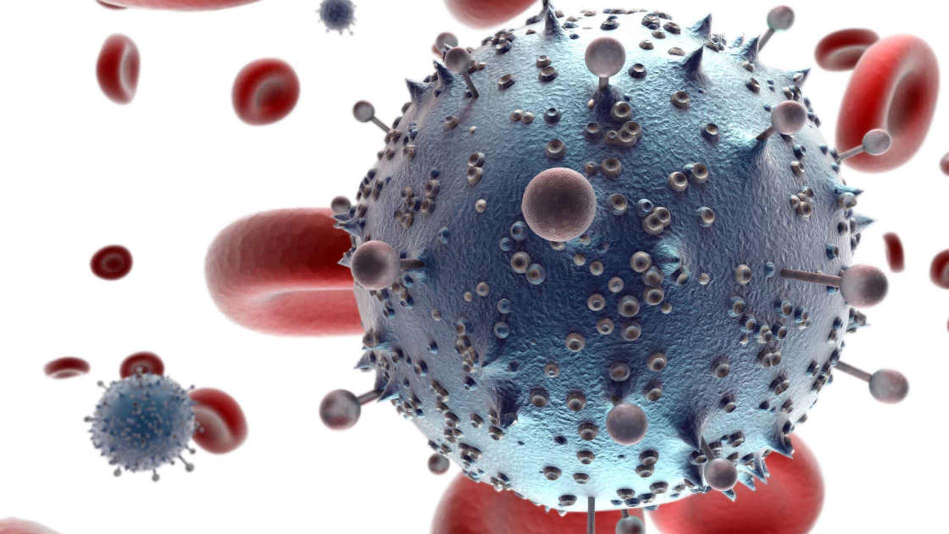 Virus del SIDA