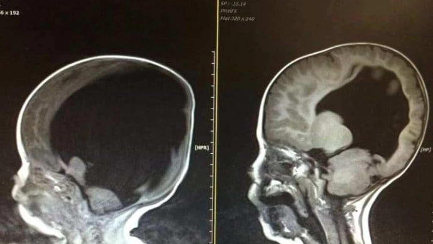 Noah Wall, el niño que desafía a la medicina con un "milagro" Noah Wall, el niño que desafía a la medicina con un "milagro"