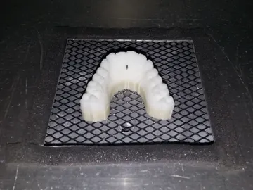 Dentadura impresa Dentadura impresa