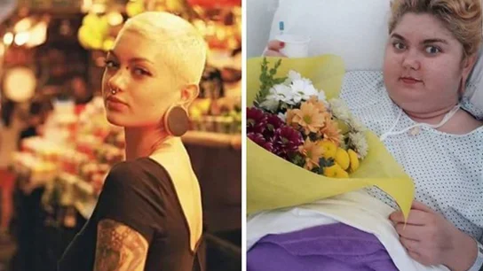 Ana antes y después de la enfermedad Ana antes y después de la enfermedad